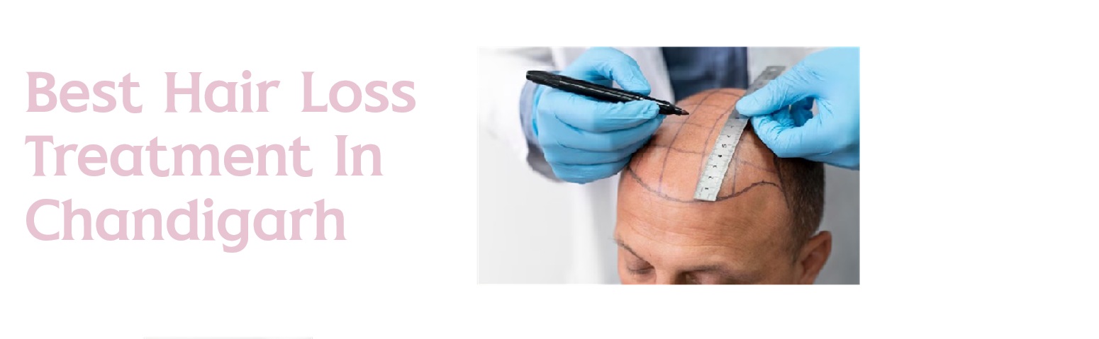  Best Hair Loss Treatment in Chandigarh 
